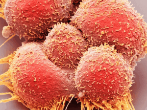 Introducción al estudio del cáncer