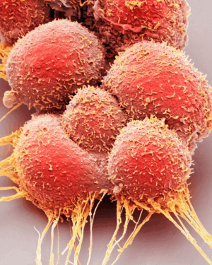 Introducción al estudio del cáncer